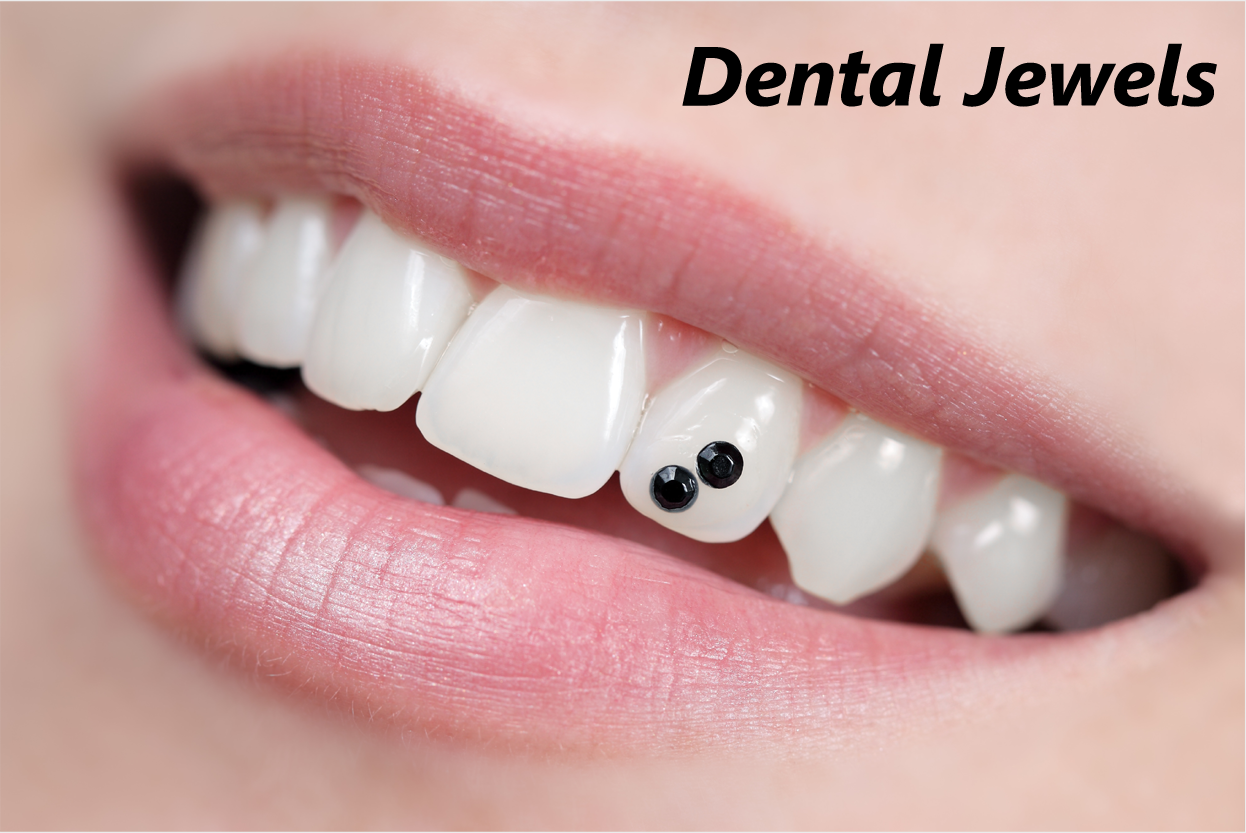 Dental Jewellary